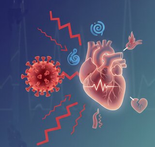 Tackling the Enduring Cardiovascular Impact of COVID-19: New Guidance for Primary Care